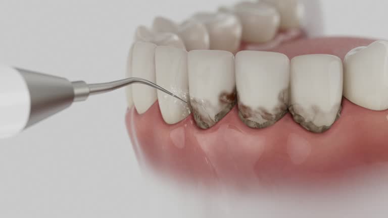 Trusted Emergency Dentist service in Montrose, MI - Dentist Open Now